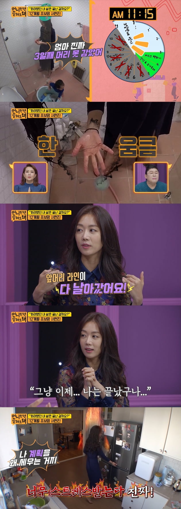 '언니한텐' 서현진, 계획 강박+육아 고충 "스트레스성 탈모 왔다" [종합]