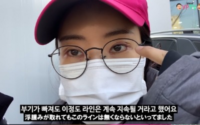 이세영, 쌍꺼풀 수술 실밥 제거 직후 모습…♥남자친구 "예쁘다" 연발 [종합]