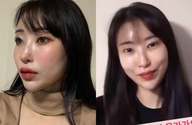 이세영 쌍꺼풀 수술 전후 /사진=인스타그램