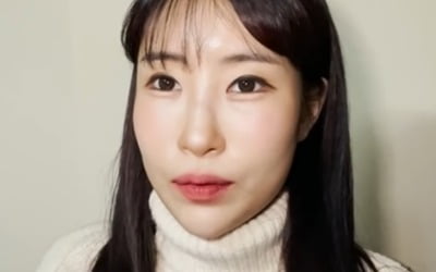 이세영 "수면마취 때 '외꺼풀 사요나라' 외쳐…쌍꺼풀 大만족"