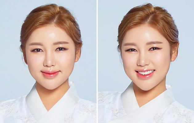 가수 송가인./ 사진제공=포켓돌스튜디오