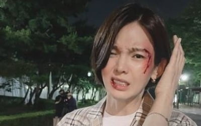 정가은, 피투성이 상처 해명 "분장이에요" [TEN★]