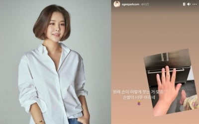 박은지, 임신 후 퉁퉁 부은 손발에 통증 호소 "너무 아프네" [TEN★]