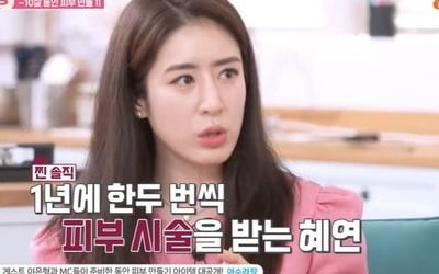 '주진모♥' 민혜연 "동안 비결=재생 주사, 매년 시술받는다"('아수라장')[종합]
