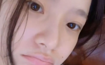 '이욱♥' 벤, 다리 깁스 후 답답함에 오열 [TEN★]