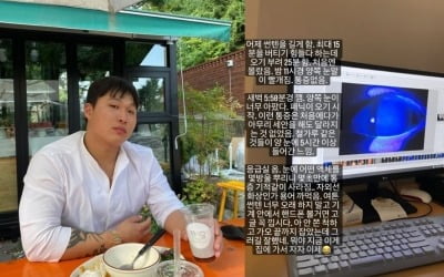 스윙스, 장시간 선탠에 응급실行 "양쪽 눈 너무 아파서 패닉" [TEN★]