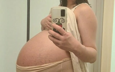 [전문] 104kg 넘은 황신영, 곧 출산 "튼살 징그러워, 일어나기도 힘들다" [TEN★]