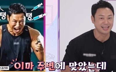 양치승, 인상 쓴 이유? "보톡스 맞아서 얼굴이 안 움직여" ('국민영수증')