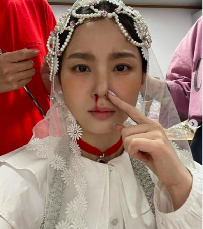 이하이, 코피 철철…스케줄이 과했나 [TEN★]
