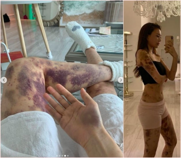 사진=아옳이 인스타그램