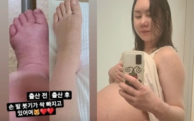 황신영, 출산 전 104kg였던 삼둥이맘 "부기 싹 빠지고 있어요"…홀쭉해진 발 [TEN★]