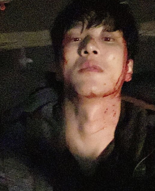 안보현, 피범벅 무슨일?…잘생김 얼룩 졌네 [TEN★]