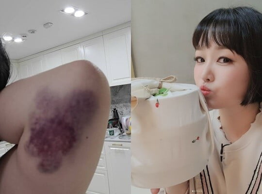 (사진=정미애 SNS)