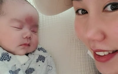 '삼둥이맘' 황신영, 태어난 지 100일 안 된 둘째 아들 수술→퇴원 "재발 안 돼" [TEN★]