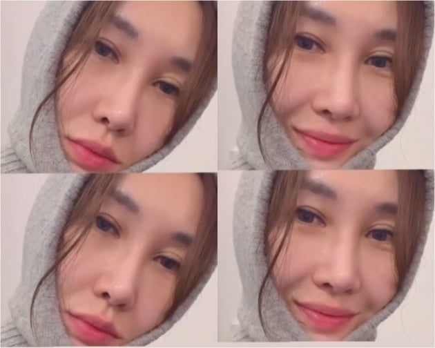 '엄태웅♥' 윤혜진, 얼굴에 압박붕대?…"비슷하네 그래"  [TEN★]
