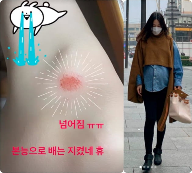 '만삭' 이지혜, 넘어짐 사고에 '부상'…"본능으로 배는 지켜" [TEN★]