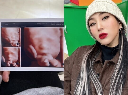 (사진=자이언트 핑크 SNS)