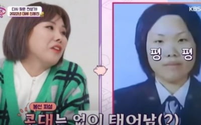 [종합] 신봉선, '소새끼' 성형 의혹 해명…"눈 안 했고 코만 2번" ('국민영수증')