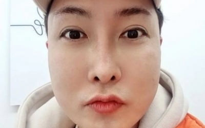 '안면윤곽 성형' 김기수, 얼굴 붓기 심각 "미치겠네" [TEN★]