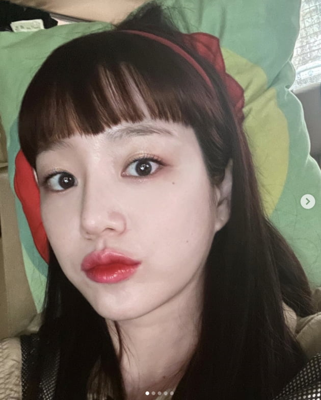 '필러 모델' 이유비, 입체적인 얼굴+도톰한 입술…32살 맞아? [TEN★]