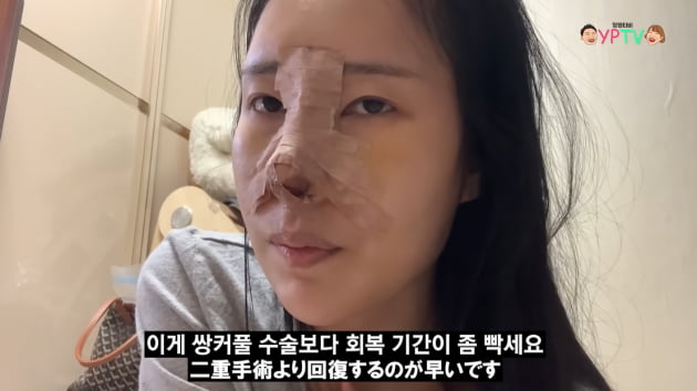 이세영, 대박 난 코성형…충격적인 붓기→완벽한 버선코 "만족스럽다" [TEN★]