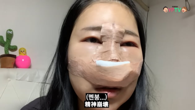 이세영, 대박 난 코성형…충격적인 붓기→완벽한 버선코 "만족스럽다" [TEN★]