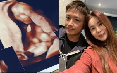 진태현 "♥박시은 임신 5개월…두 번 유산 판정 후 기적같은 숫자" [TEN★]