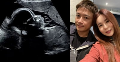 진태현 "'임신' ♥박시은, 곧 23주"…눈코입 또렷한 초음파 사진 "엄마 닮아라" [TEN★]