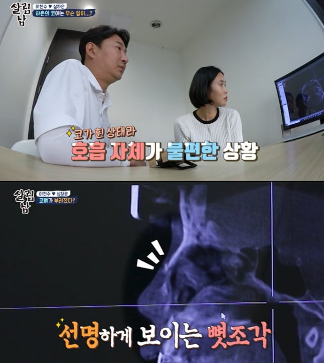 [종합] '이천수♥' 심하은 "성형 부작용으로 코 찌그러져…'성괴' 악플 마음의 상처" ('살림남2')