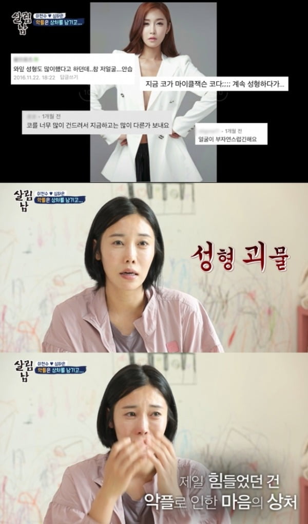 [종합] '이천수♥' 심하은 "성형 부작용으로 코 찌그러져…'성괴' 악플 마음의 상처" ('살림남2')