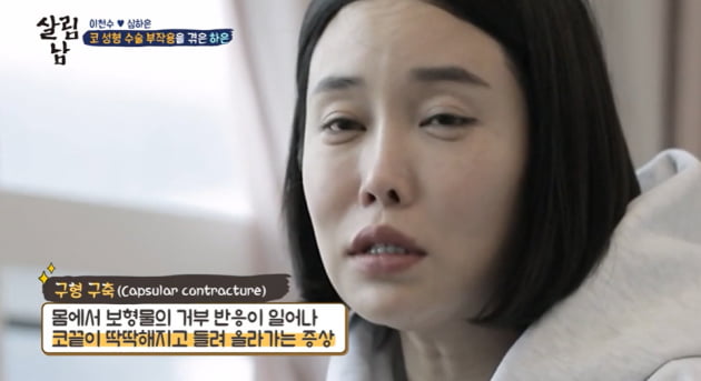 [종합] '이천수♥' 심하은 "성형 부작용으로 코 찌그러져…'성괴' 악플 마음의 상처" ('살림남2')