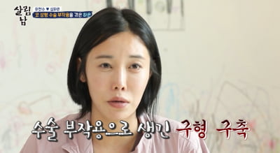 [종합] '이천수♥' 심하은 "성형 부작용으로 코 찌그러져…'성괴' 악플 마음의 상처" ('살림남2')