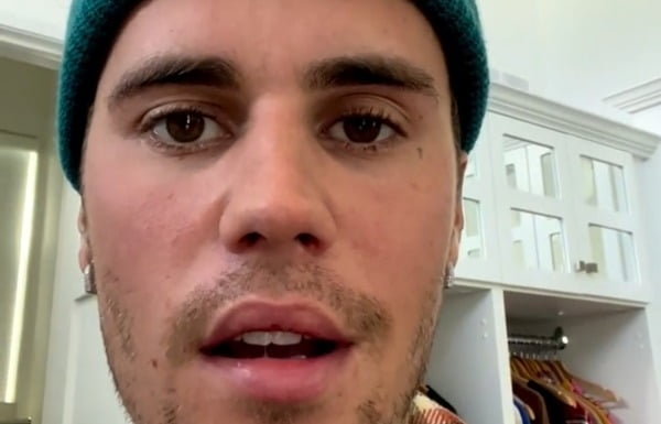 저스틴 비버, 희소병으로 왼쪽 얼굴 마비 "웃을 수도 없다"[TEN★]