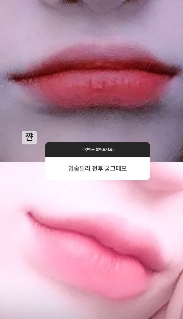 '故 최진실 딸' 최준희, 시술 전후·다이어트 자극 사진 공개 [TEN★]