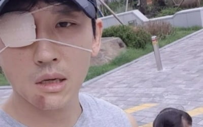 '구안와사' 박지헌, 투병 중에도 육아는 계속…"웃으면 복이 와요"[TEN★]