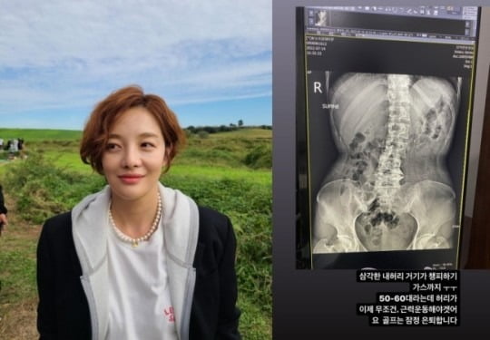 황보라 / 사진=황보라 인스타그램