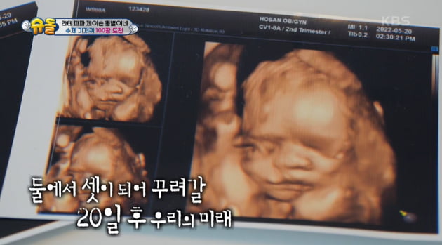 [종합] '만삭' 홍현희, 출산 앞두고 쏟아진 선물…차태현 유모차에 제이쓴 "실감 나" ('슈돌')