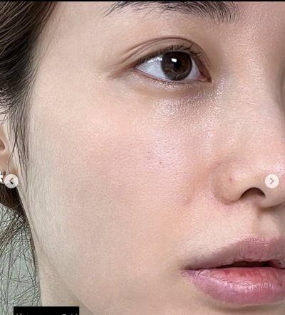 "사람이면 다 있죠"…유깻잎, 모공·피지·잔털 적나라한 민낯 공개 [TEN★]