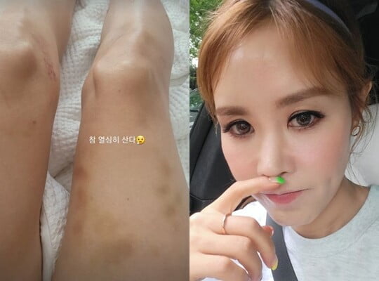(사진=채리나 SNS)