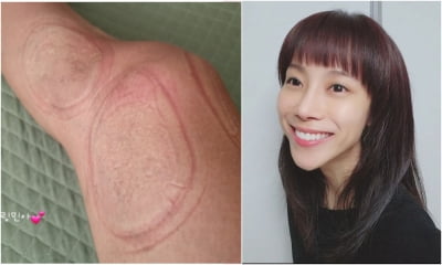 조민아, 무릎 연골연화증·몸살감기…컨디션 난조 호소 [TEN★]