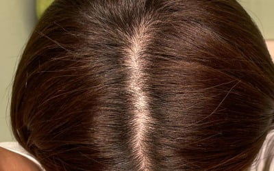 아이비, 난해한 두피 모공 사진…한효주도 '충격'[TEN★]
