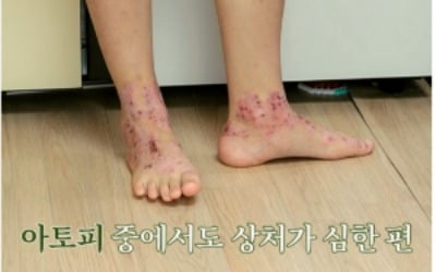 아동학대 아냐?…쓰레기집에 방치된 삼남매 "소변 실수해도 안 씻겨" 충격 ('우아달2')