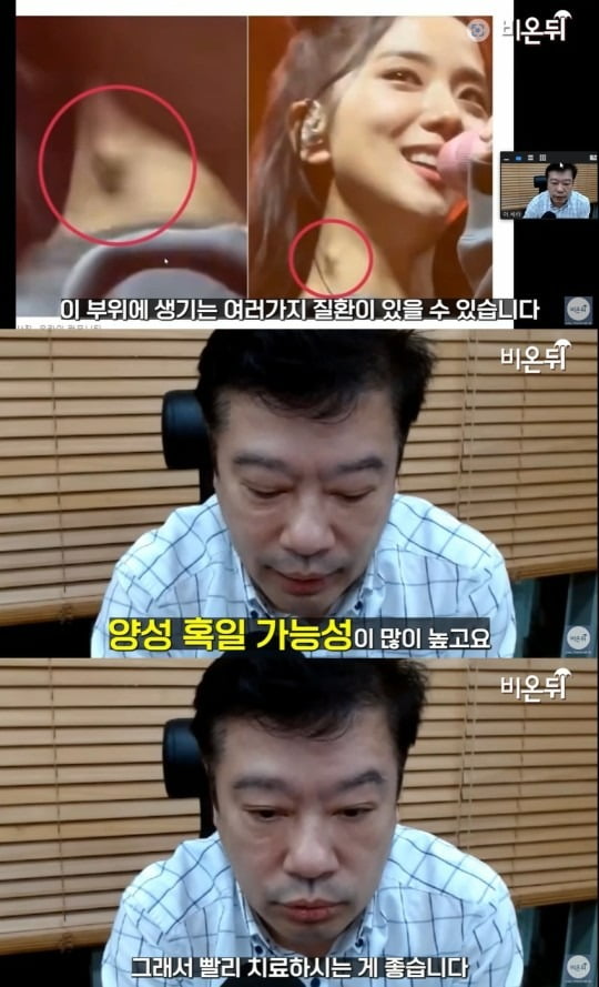 사진=유튜브 채널 '의학채널 비온뒤' 영상 캡처