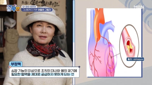 [종합] '복길엄마' 김혜정, "'전원일기' 후 우울증 …부정맥에 '완전한 공포' 느껴"('알약방')