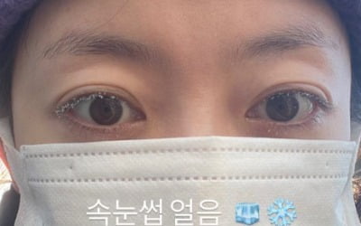 "속눈썹 얼음" 전소민, 코끝 '찡'한 겨울 추위에 완전 무장 소용없네
