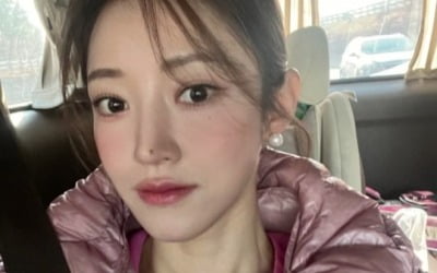 서하얀, 부은 얼굴에도 '굴욕無' 미모…♥임창정 또 반하겠네