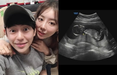 '8살 연하 안용준♥' 베니, 결혼 8년 만에 44세 고령 임신 '축하 봇물'