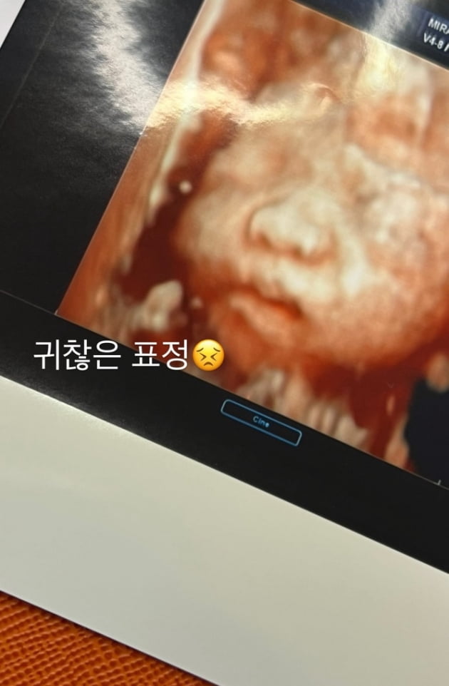 '사업가♥' 최희, 출산보다 임신이 힘든 예비 둘째맘 "만삭만큼 배 나왔다"
