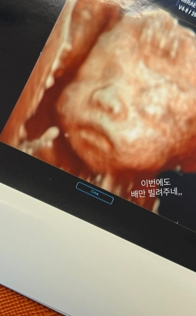 '사업가♥' 최희, 출산보다 임신이 힘든 예비 둘째맘 "만삭만큼 배 나왔다"