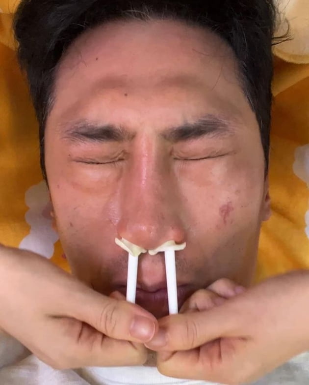 김재우, ♥조유리 덕 생애 첫 코털 왁싱…"코 이렇게까지 늘어나나?"